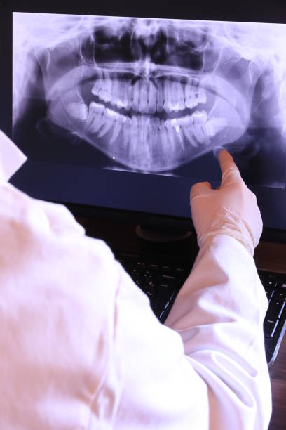 Best Chipped Tooth Repair Near Me  in Seminole Manor, FL